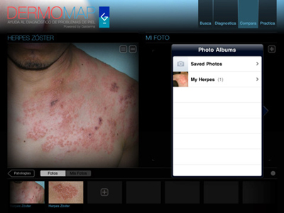 Imagen 1/2